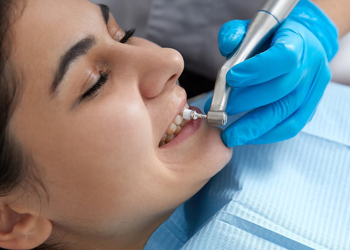 Dental Exams & Screenings at Clark St Dental of Lakewood