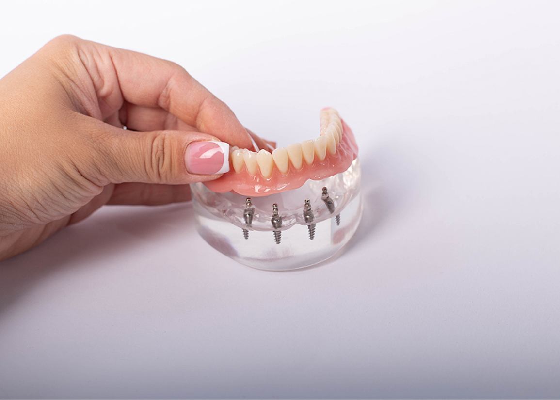 Complete & Partial Dentures at Clark St Dental of Lakewood