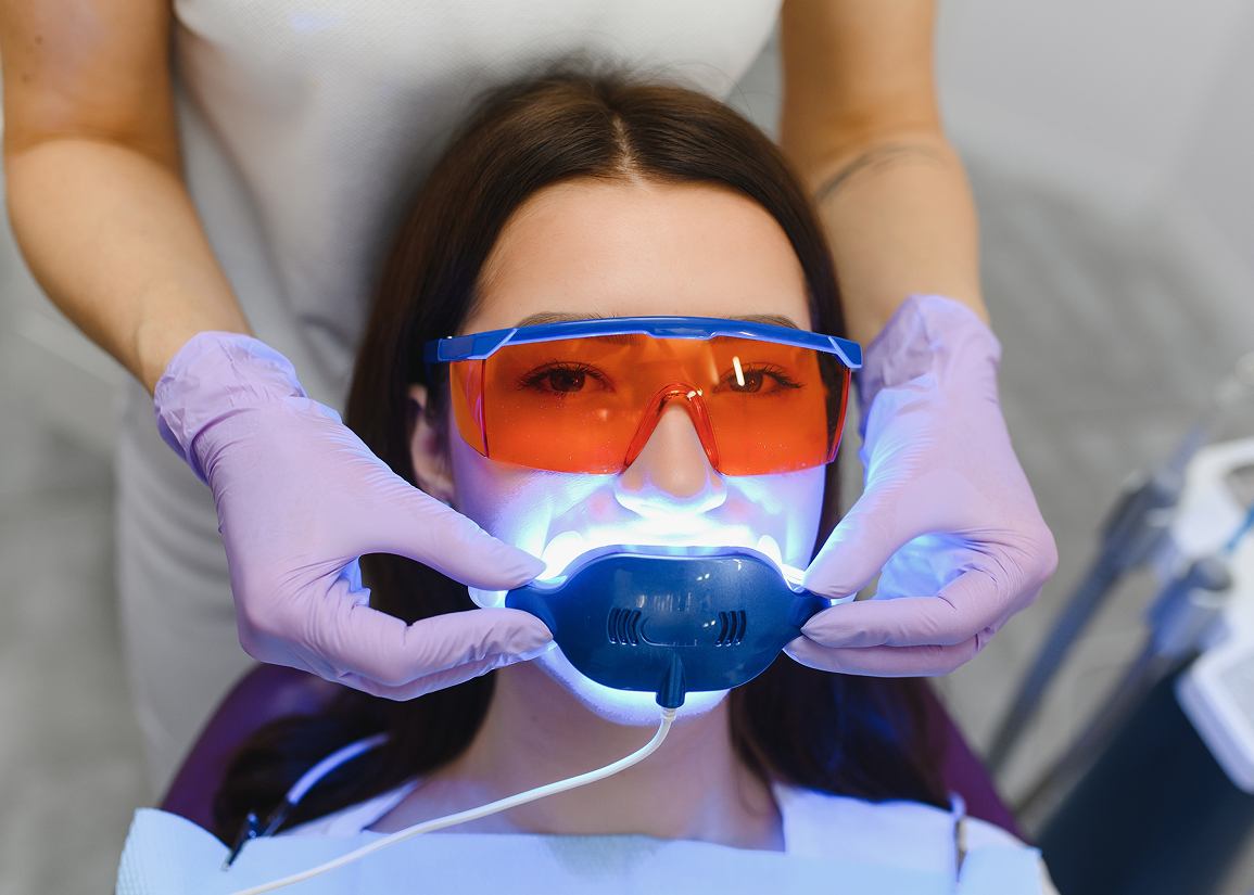 Professional Teeth Whitening at Clark St Dental of Lakewood